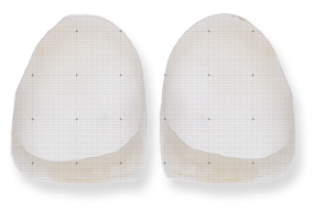 Carillas de porcelana pura